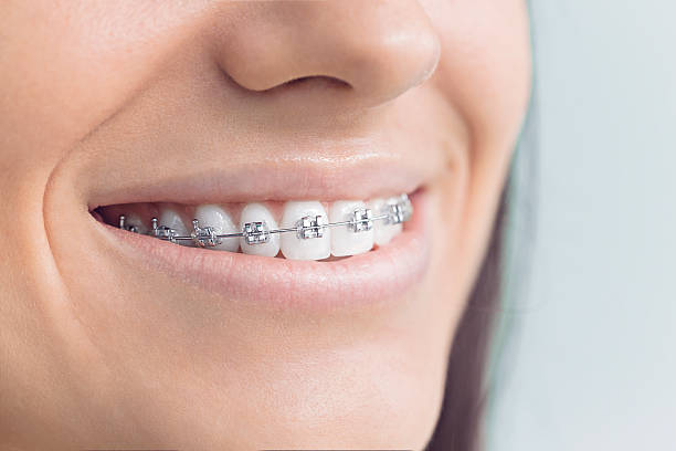 Best Teeth Whitening  in Raymond, WA